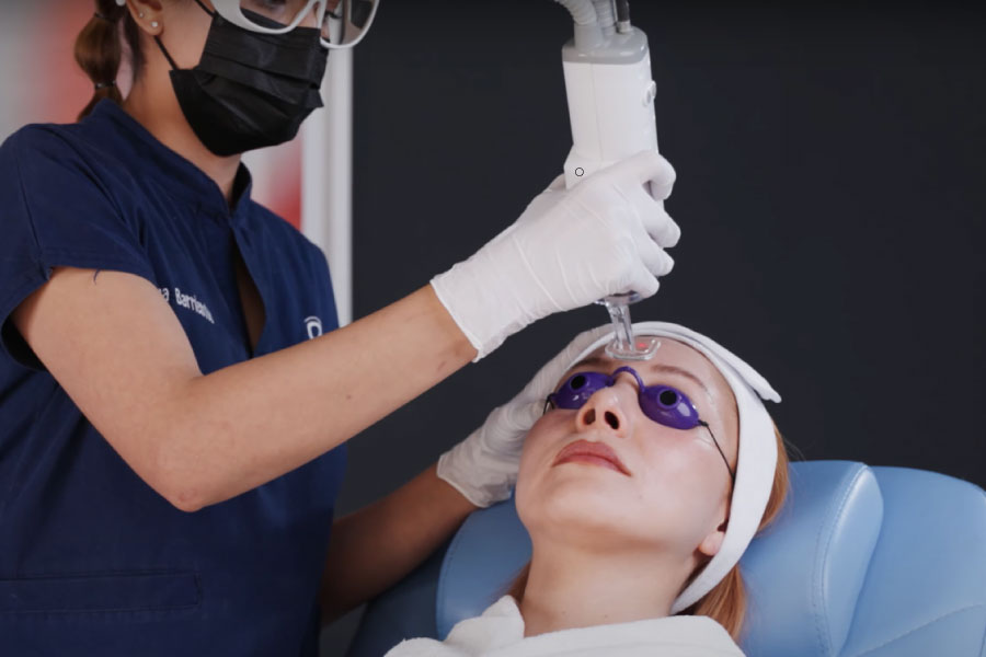 Aplicación clínica de Edge ONE en procedimiento de rejuvenecimiento facial con láser CO₂ fraccionado