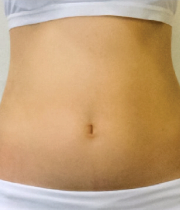 Comparativa clínica antes del tratamiento con PowerShape2