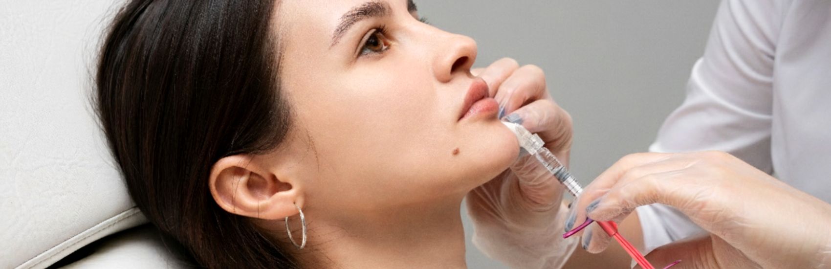 MONALISA SMILE, relleno labial médico con equilibrio ideal entre volumen y elasticidad.