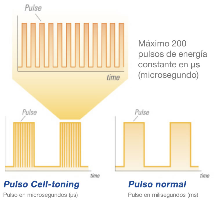 Tecnología Cell-Toning de de Cellec V